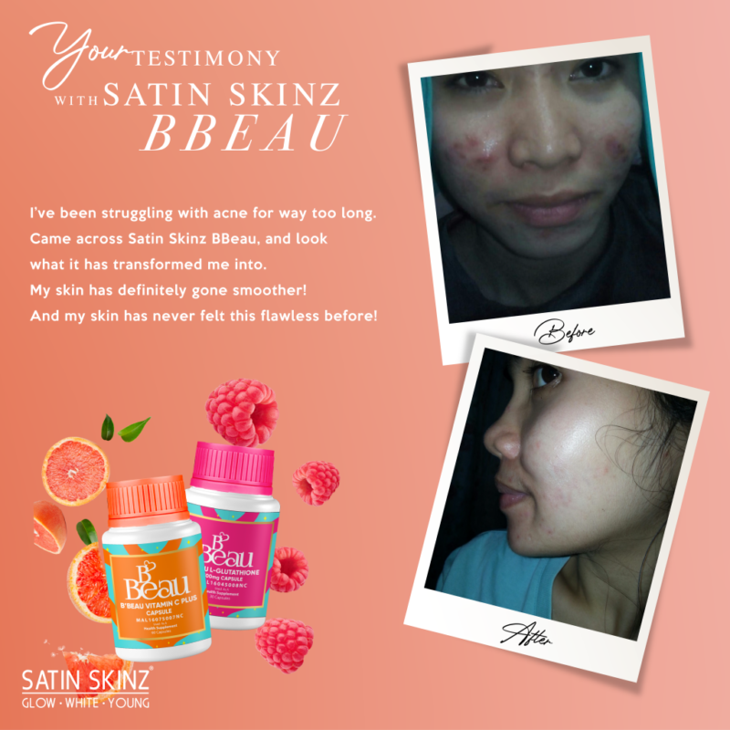 Satin Skinz B'Beau Glutathione and Vitamin C Set - Image 3