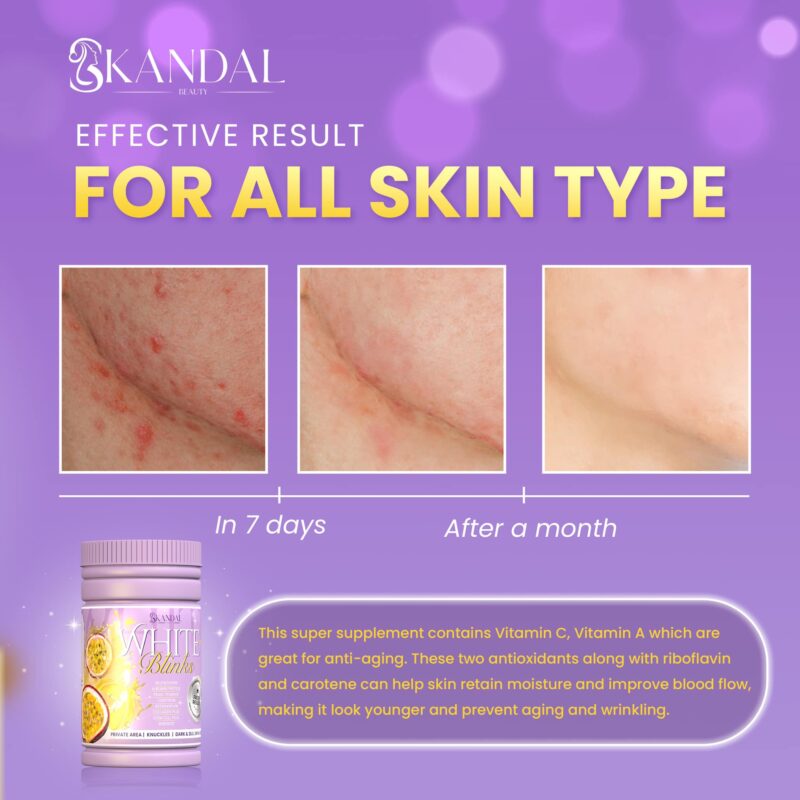 White Blinks Skin Whitening Supplement - Image 5